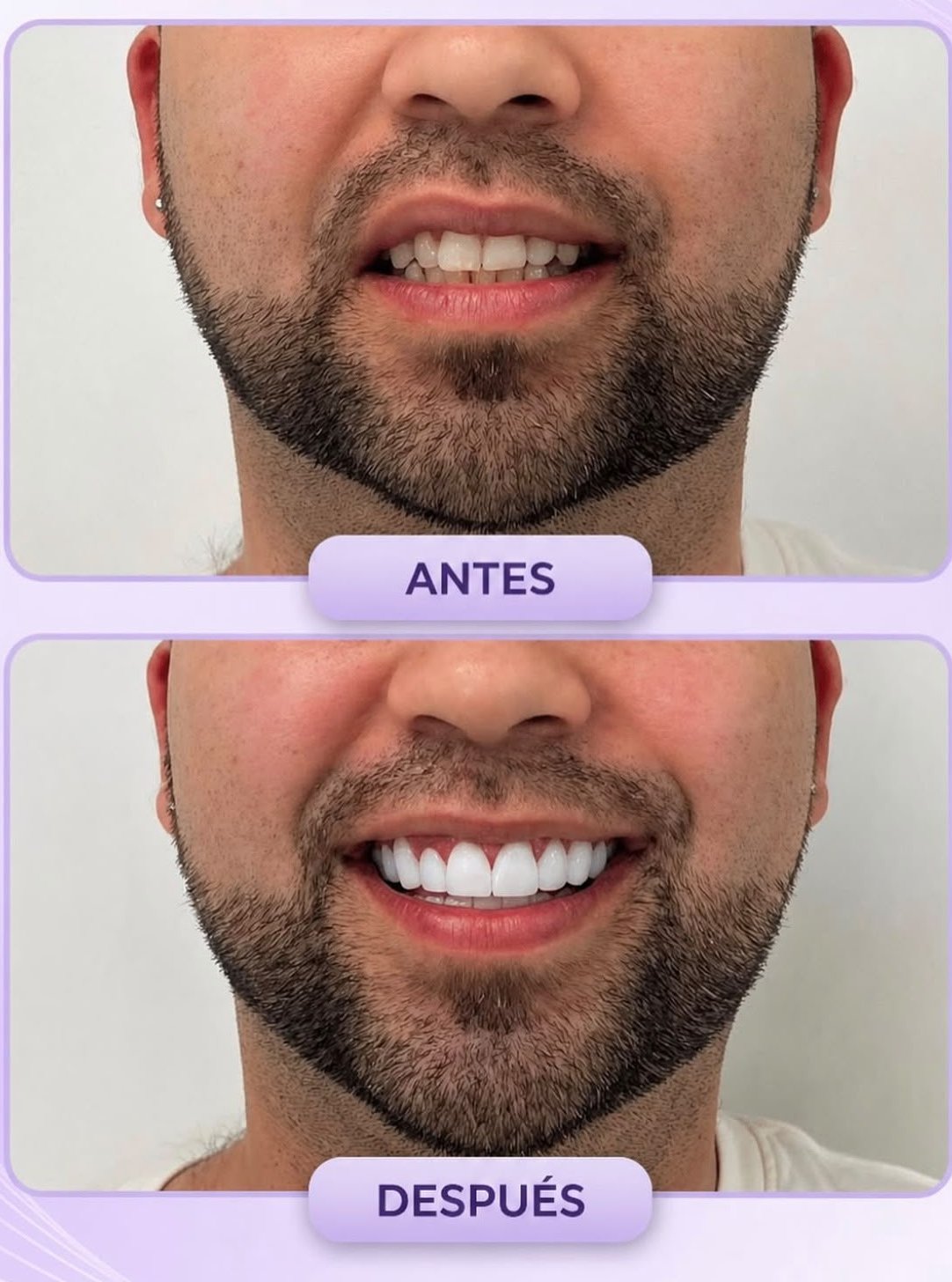 Resultado real de un paciente: antes y después