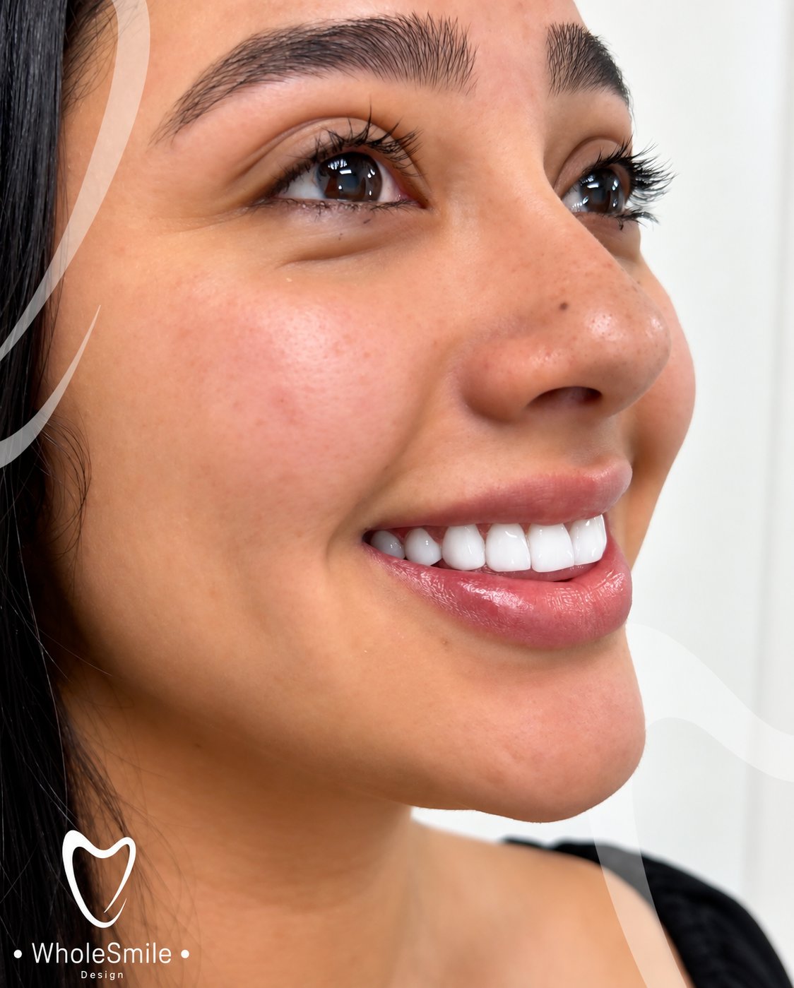 Paciente de Whole Smile Design sonriendo de perfil